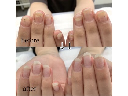 ネイルアロマ(Nail AROMA)の写真