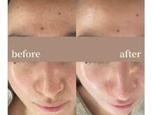 ユーアンドハニー(U&Honey.)/ファンデの色ワントーン上がる！