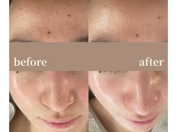 ユーアンドハニー(U&Honey.)/ファンデの色ワントーン上がる！