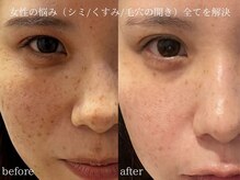 ルミナ シブヤ(LUMINA SHIBUYA)の雰囲気(その場で効果実感!変化を楽しめるシミスポットで根本改善!)