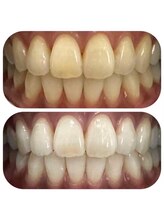 ボディケアアップ(BODY CARE UP↑)/本来の白さを目指す