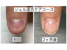 かずっちの雰囲気(個人差ありますが2ヶ月でキレイな爪に導きます!)