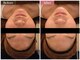 アイリスエステサロン 那覇小禄店の写真/「しみ＆しわ」をなかったことに！サロンケア最高水準の美容液や美容マシンでホームケアの効果もUPさせる