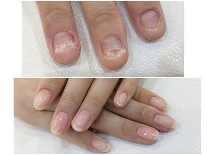 シャンネイルケアサロン(Shan Nail caresalon)の写真