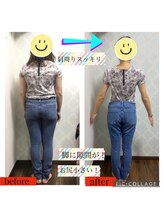 トータルケアーサロン アクア 時津(AQUA)/ダイエット：ビフォーアフター