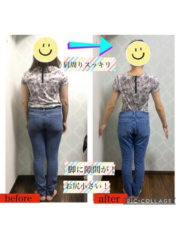 トータルケアーサロン アクア 時津(AQUA)/ダイエット：ビフォーアフター