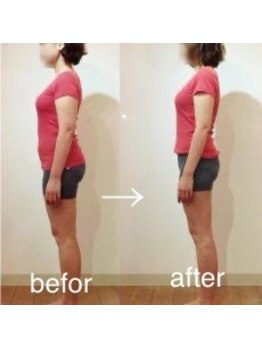 カイロプラクティック ネクサス/産後の骨盤の歪み撃退☆