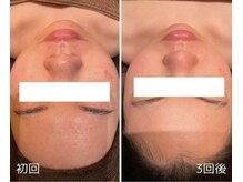 チェンジ 小山店(Change)/