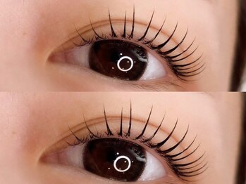 アリー(Ally)/ラッシュリフト