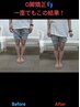 【O脚矯正！】見た目が変わる！Ｏ脚・骨盤の徹底矯正 初検料込 ¥9900→¥6600