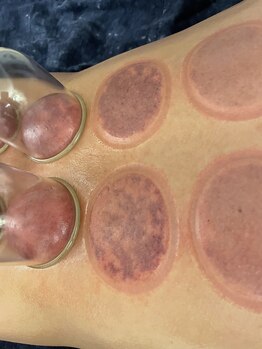 リラク笑美(reraku笑美)/