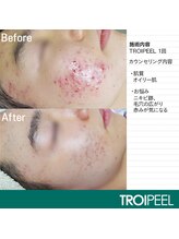 オン(on.)/《お客様症例》施術1回