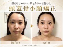 ポーベルポー(Peau Belle poe)