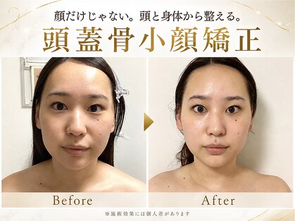 ポーベルポー(Peau Belle poe)の写真