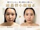 ポーベルポー(Peau Belle poe)の写真