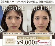 エスピーエー 桂坂(S.P.A)