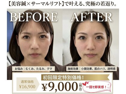エスピーエー 桂坂(S.P.A)の写真