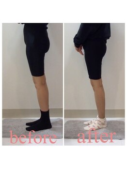 スタイルラボ高松/産後骨盤矯正の効果♪