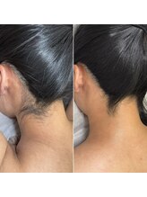 インベスト(INVEST)/Before After 