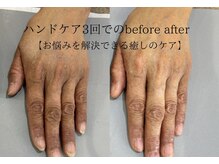 オテテ アイアンドハンド(otete eye&hand)