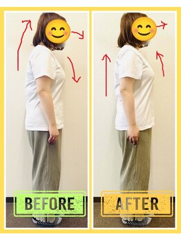 やくいん整骨院 薬院店/姿勢ビフォーアフター