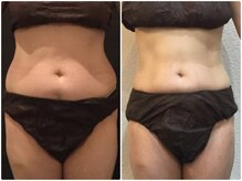 美容整体ウェリナ あま甚目寺院/小顔矯正/骨盤矯正/美脚サロン