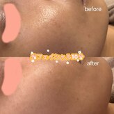 シューティングハーツ(SHOOTING HEARTS)