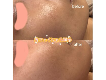 シューティングハーツ(SHOOTING HEARTS)の写真