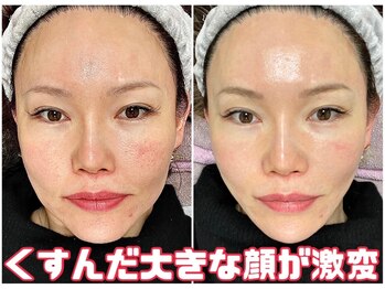 スペチアーレ 夙川/くすみも取れて美顔革命