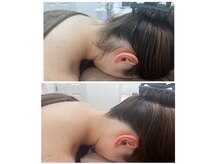 ミース 京都駅前店/うなじビフォーアフター