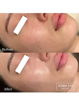 イリマレイサロン(iLima Lei SALON)/内側から輝く美肌