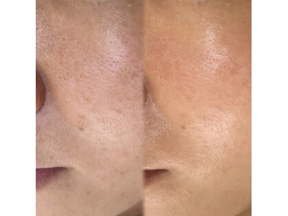 アトリーチェ ベレッツァ(ATTRICE Bellezza)の写真