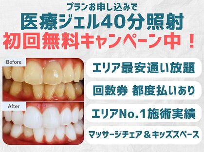 スマイルホワイト 赤羽店の写真