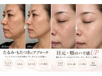 Total beauty salon SOIA【ソワエ】横浜天王町/毛穴・小顔・痩身・リンパマッサージの写真/ぼやけた輪郭に。キュッと引き締まった小顔印象へ