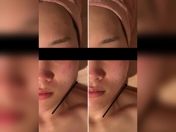 フェアリー 小松店/Before→After　その２