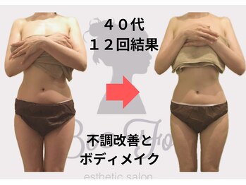 ビーフォー(be for)/月２回ご来店の結果♪