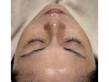 アドビューティ(Add Beauty)/≪たるみ改善／RFリフティング≫