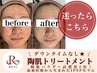 【人気No.1】 トラブル肌緩和に◎REVIハーブピーリング×IPS美容液