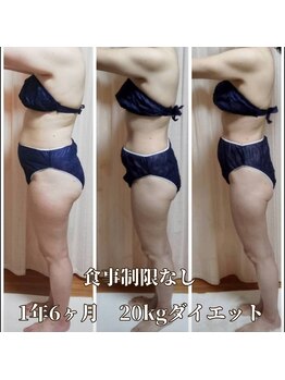 ヨサパーク サーナ 仙川(YOSA PARK Sana)/40代お客様ビフォー⇒アフター