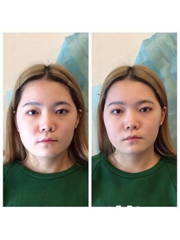 健幸堂 本店/小顔今日1回