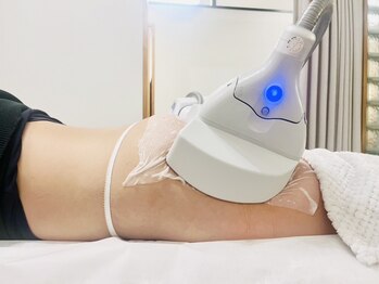 イルミナ(ILLUMINA)の写真/【話題の脂肪冷却☆】無駄な脂肪を冷却効果で分解させる☆ダウンタイムなしで、結果重視◎