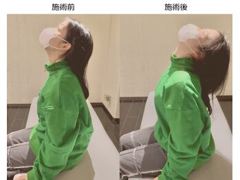 名古屋栄 肩こり腰痛専門整体 らーく/お客様のbefore、after