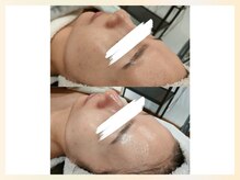 ソウナ(SONA)/ハリ・ツヤUP☆ララピール