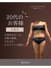 レディラック 大阪梅田本店(Lady Luck)/がっつりサイズダウンコース