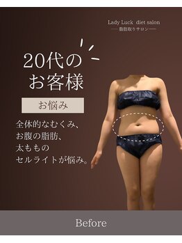 レディラック 大阪梅田本店(Lady Luck)/がっつりサイズダウンコース