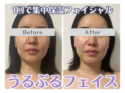 ルリアン(Lurian)の写真