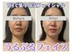 ルリアン(Lurian)の写真
