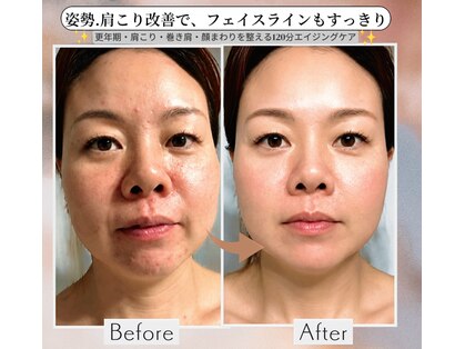 ココベルプラス(CoCo Bellepuls)の写真