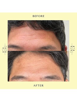 スタイルドアー(style door)/ExoLift