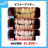 ホワイトニングショップ 長岡京店